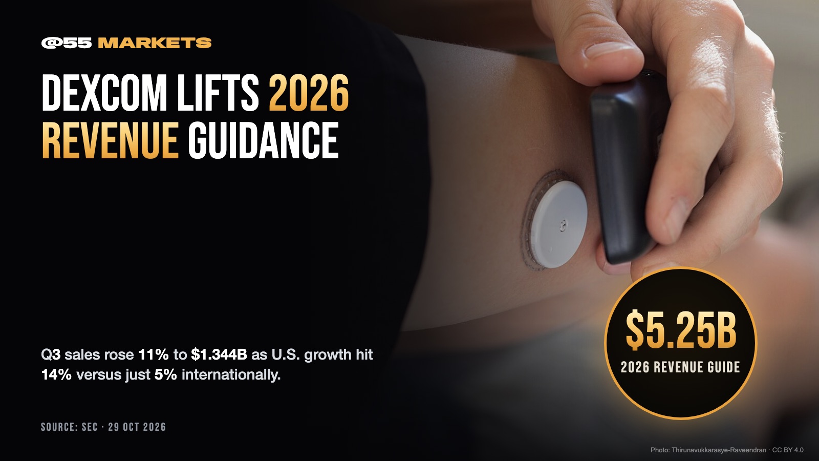 DEXCOM LIFTS 2026 REVENUE GUIDANCE, ADDS $1B BUYBACK